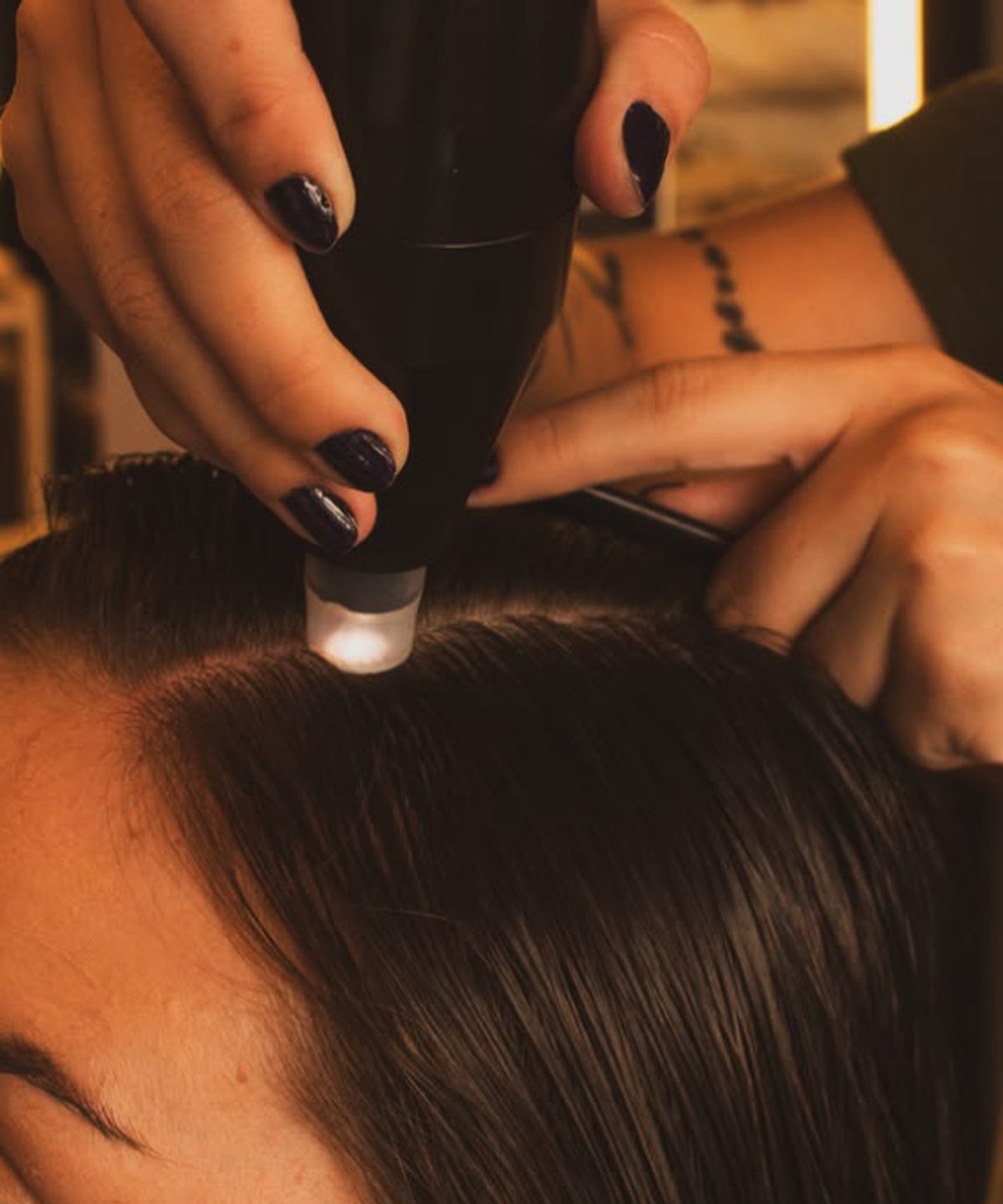 Avaliação do couro cabeludo com dermatoscópio no MH Botânica